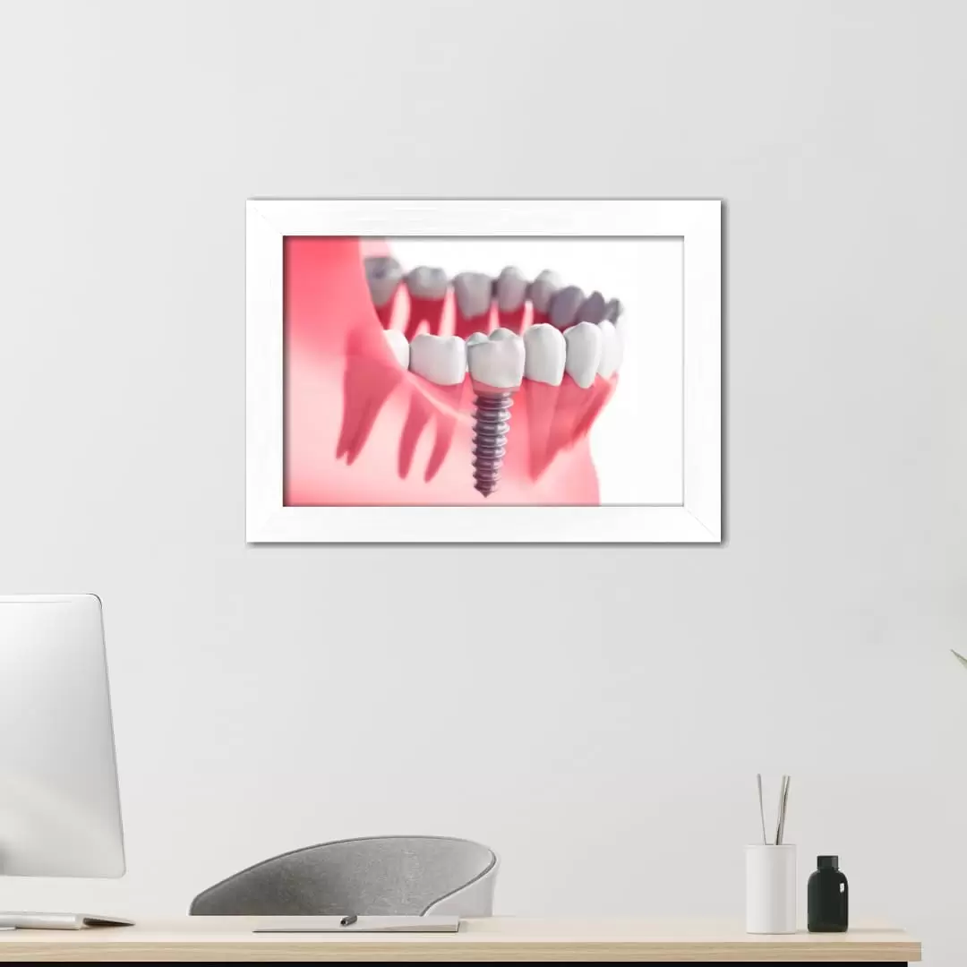 Quadro Decorativo Ilustração - DenteRaioX - Imagem 2