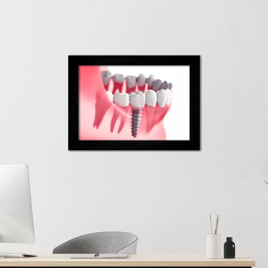 Quadro Decorativo Ilustração- DenteRaioX - Moldura Preta - Quadro Decorativo Ilustração - DenteRaioX - Moldura Preta -