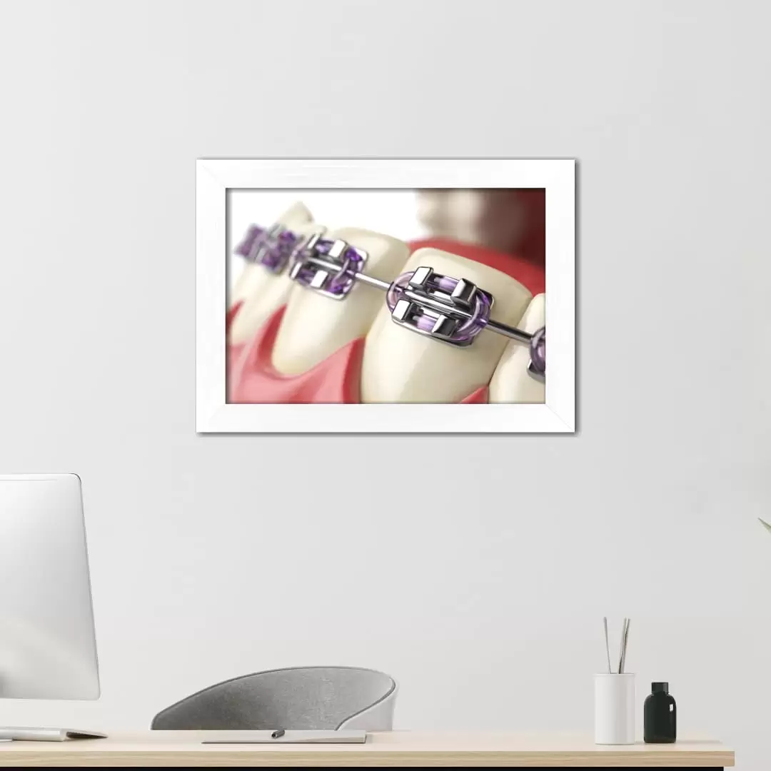 Quadro Decorativo Ilustração - Aparelho - Imagem 2