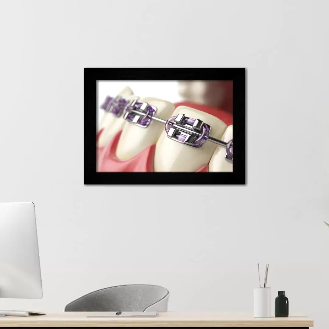 Quadro Decorativo Foto - Aparelho - Moldura Preta - Quadro Decorativo Foto - Aparelho - Moldura Preta -