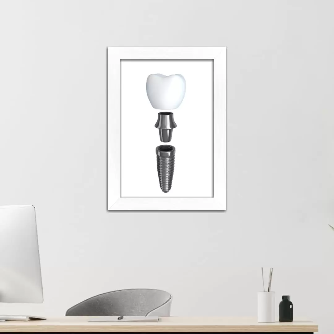 Quadro Decorativo Ilustração - Dente - Imagem 2