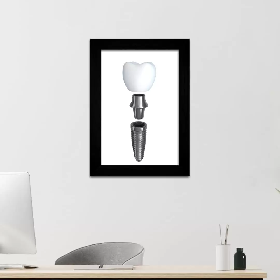 Quadro Decorativo Ilustração Dente - Moldura Preta - Quadro Decorativo Ilustração- Dente - Moldura Preta -