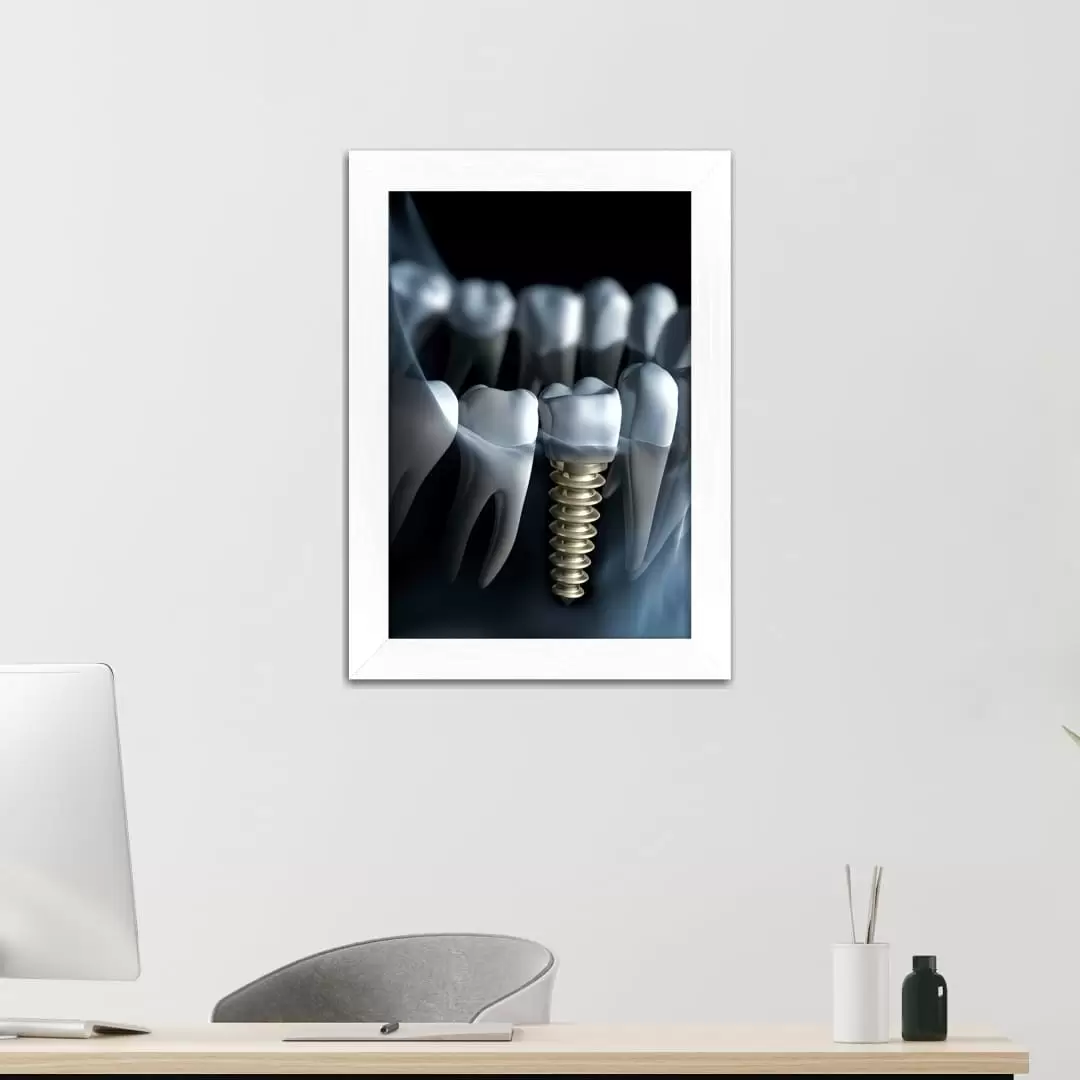 Quadro Decorativo Ilustração - RaioX - Imagem 2