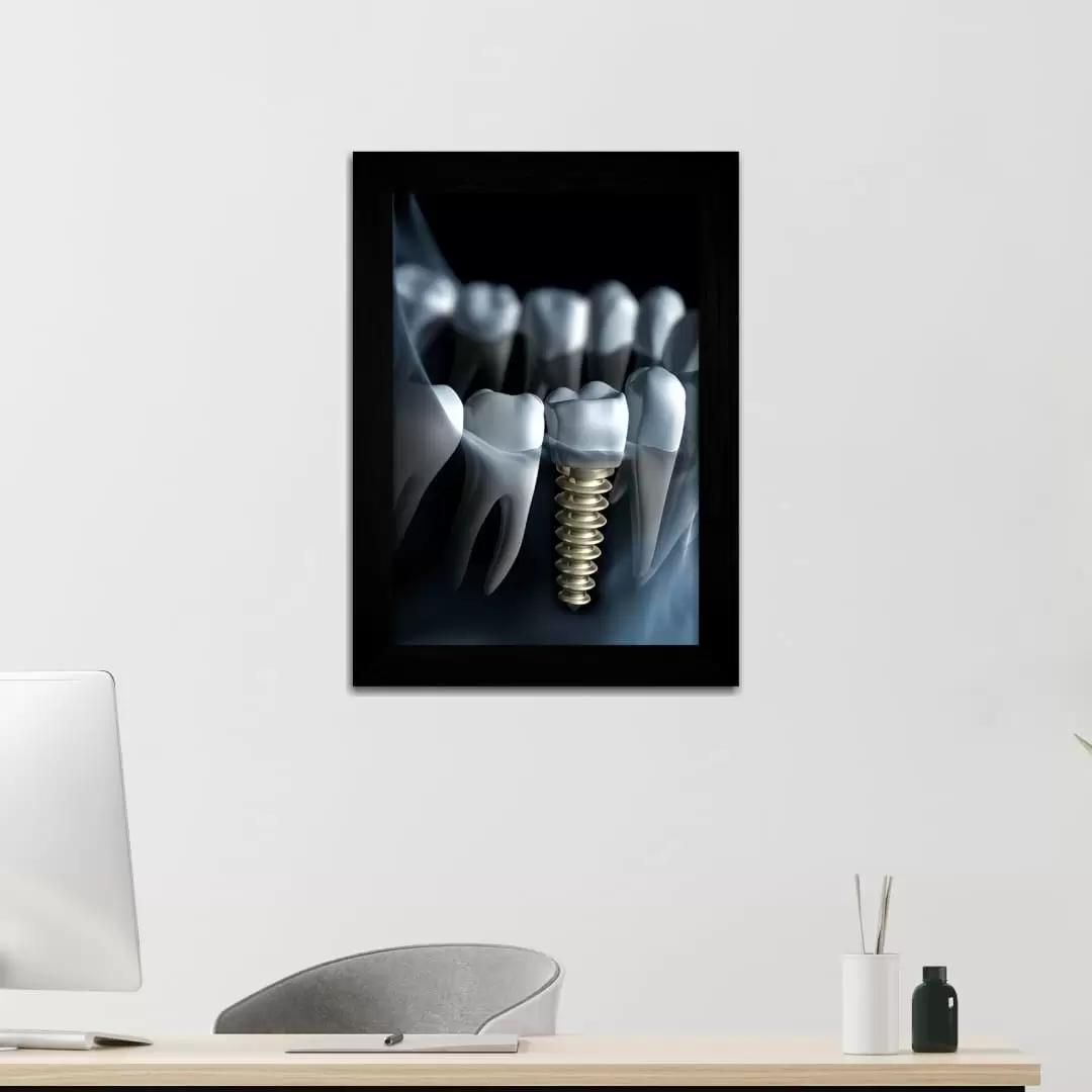 Quadro Decorativo Ilustração - Raio X - Moldura preta - Quadro Decorativo Ilustração - Raio X - Moldura preta -